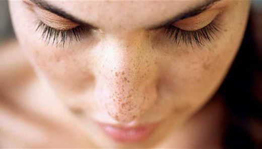 Yüzdeki Lekeler İçin Maske Tarifi ve Malzemeleri